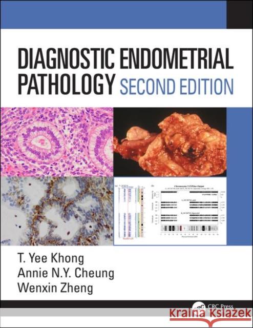 Diagnostic Endometrial Pathology 2e Zheng, Wenxin 9781138626416 Routledge - książka