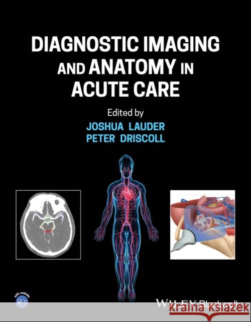 Diagnostic Imaging and Anatomy in Acute Care Peter Anthony (Hope Hospital, Salford, UK) Driscoll 9781119809449  - książka
