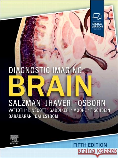 Diagnostic Imaging: Brain Miral D. (Colonel Robert R. McCormick Professor of Diagnostic Imaging, Division Head, Neuroradiology Chair, Department o 9780443380198 Elsevier - książka