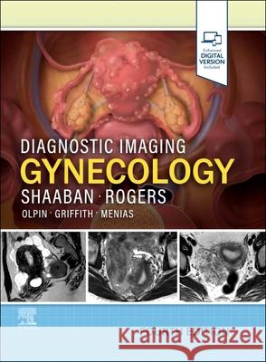 Diagnostic Imaging: Gynecology Akram M. Shaaban Douglas Rogers 9780443380396 Elsevier - książka