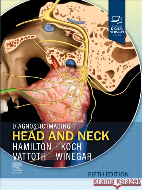 Diagnostic Imaging: Head and Neck Blair A., MD (Neuroradiology Fellowship Director, Associate Professor of Radiology and Medical Imaging, Department of Ra 9780443378904 Elsevier - książka