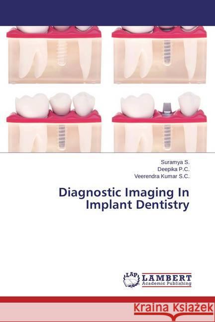 Diagnostic Imaging In Implant Dentistry S., Suramya; P.C., Deepika; Kumar S.C., Veerendra 9783659593925 LAP Lambert Academic Publishing - książka