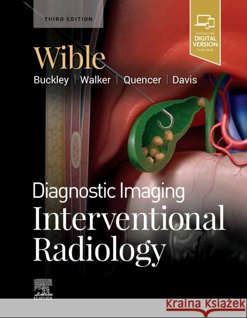 Diagnostic Imaging: Interventional Radiology Brandt C. Wible 9780323877572 Elsevier - książka