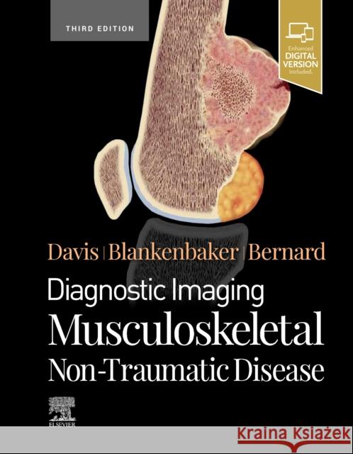Diagnostic Imaging: Musculoskeletal Non-Traumatic Disease Kirkland W. Davis Donna G. Blankenbaker Stephanie A. Bernard 9780323834735 Elsevier - książka