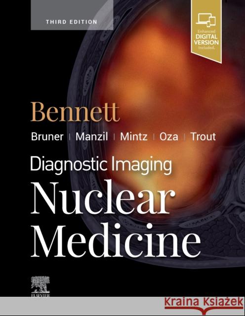 Diagnostic Imaging: Nuclear Medicine Paige A. Bennett 9780323765305 Elsevier - książka