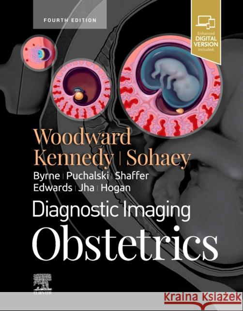 Diagnostic Imaging: Obstetrics Paula J. Woodward 9780323793964 Elsevier - książka