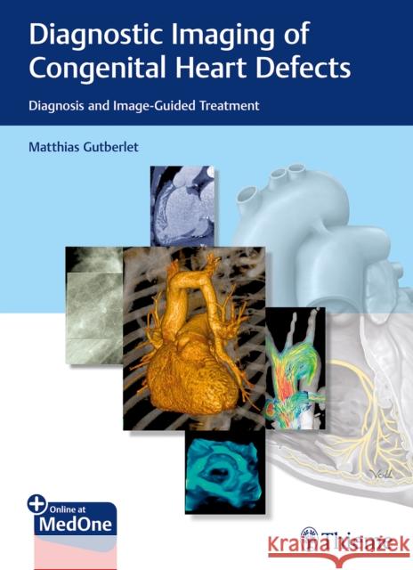 Diagnostic Imaging of Congenital Heart Defects: Diagnosis and Image-Guided Treatment Gutberlet, Matthias 9783132402515 Thieme Medical Publishers - książka