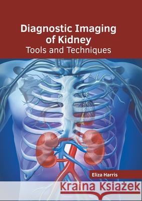 Diagnostic Imaging of Kidney: Tools and Techniques Eliza Harris 9781639891504 States Academic Press - książka
