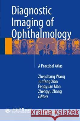 Diagnostic Imaging of Ophthalmology: A Practical Atlas Wang, Zhenchang 9789402410587 Springer - książka