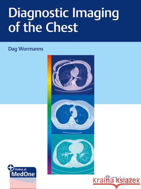 Diagnostic Imaging of the Chest Wormanns, Dag 9783132415652 Thieme Medical Publishers - książka