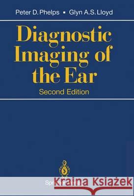 Diagnostic Imaging of the Ear Peter D. Phelps Glyn A. S. Lloyd 9781447117261 Springer - książka