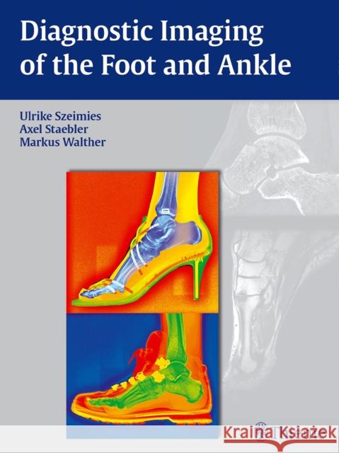 Diagnostic Imaging of the Foot and Ankle Ulrike Szeimies Axel Stbler Markus Walther 9783131764614 Thieme Medical Publishers - książka