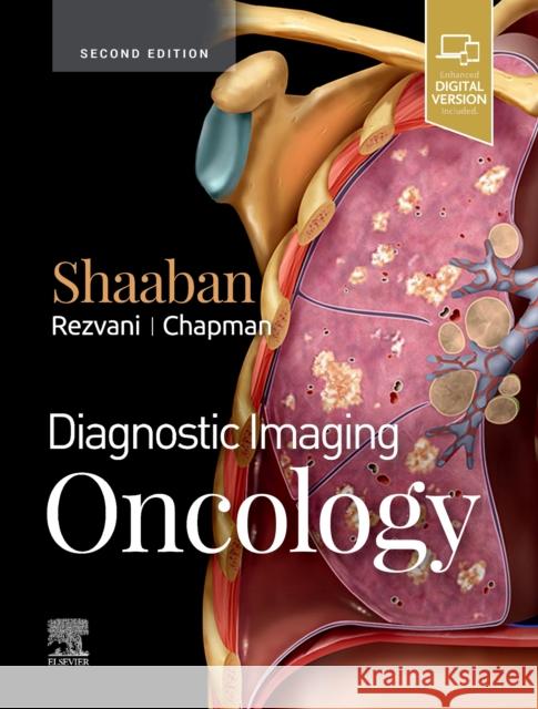 Diagnostic Imaging: Oncology Akram M. Shaaban 9780323661126 Amirsys - książka
