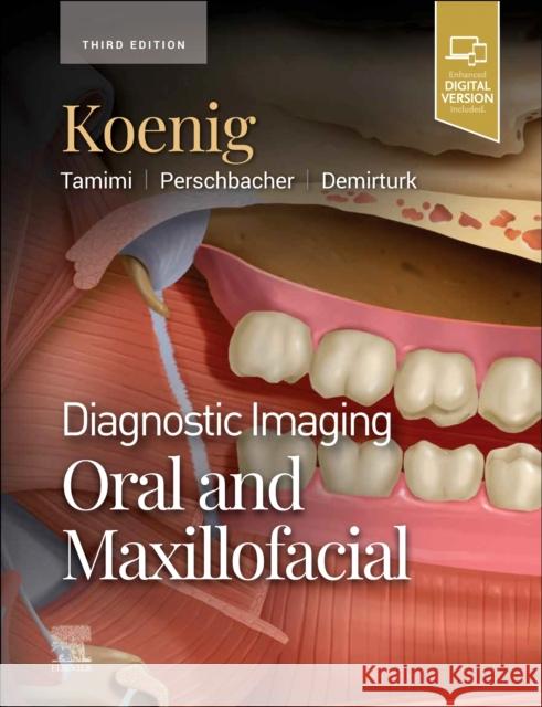 Diagnostic Imaging: Oral and Maxillofacial Husniye, DDS, MS, PhD Demirturk 9780443105319 Elsevier Health Sciences - książka