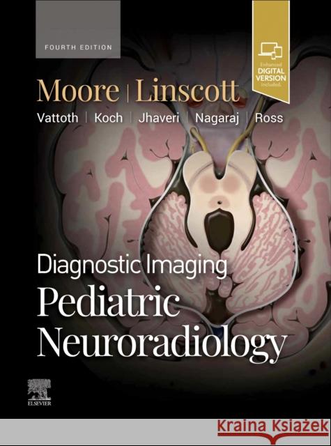 Diagnostic Imaging: Pediatric Neuroradiology Kevin R. Moore Luke L. Linscott 9780443234927 Elsevier - książka