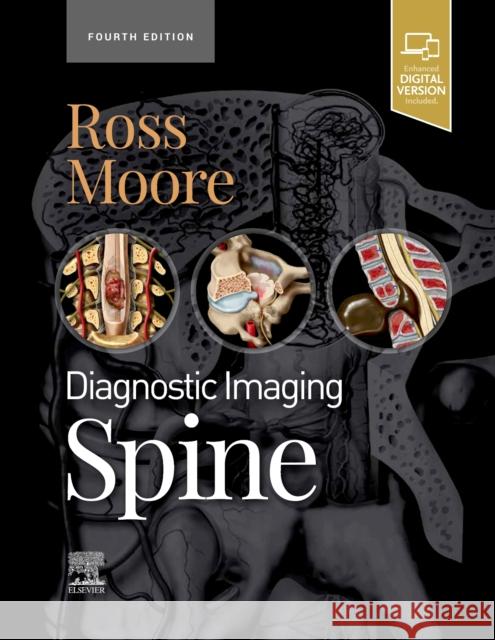 Diagnostic Imaging: Spine Jeffrey S. Ross Kevin R. Moore 9780323793995 Elsevier - książka