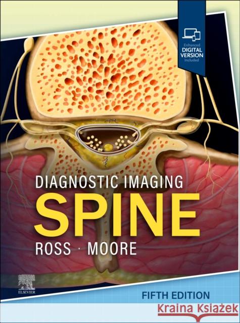 Diagnostic Imaging: Spine Jeffrey S. Ross Kevin R. Moore 9780443378812 Elsevier - książka