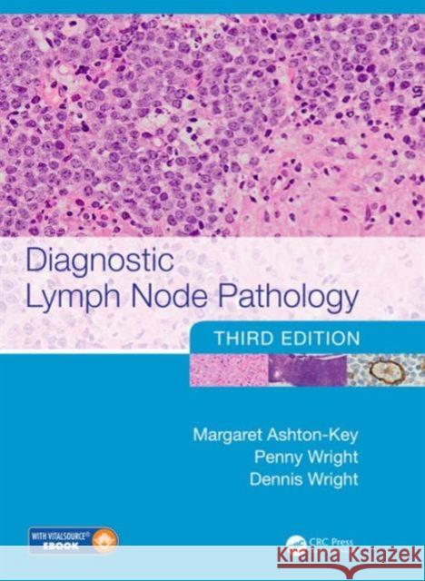 Diagnostic Lymph Node Pathology Margaret Ashton-Key Penny Wright Dennis Wright 9781498732697 Taylor and Francis - książka