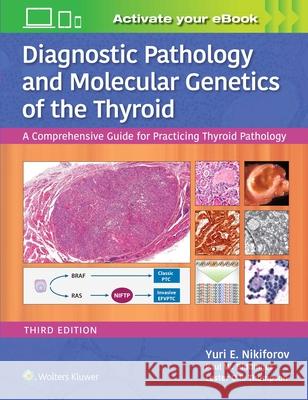 Diagnostic Pathology and Molecular Genetics of the Thyroid: A Comprehensive Guide for Practicing Thyroid Pathology Yuri Nikiforov 9781496396532 LWW - książka
