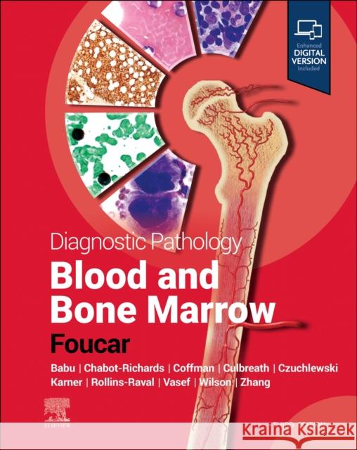 Diagnostic Pathology: Blood and Bone Marrow Kathryn Foucar 9780323878784 Elsevier - Health Sciences Division - książka