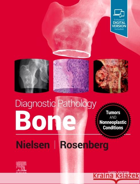 Diagnostic Pathology: Bone Gunnlaugur Petu Andrew E. Rosenberg 9780323765336 Elsevier - książka