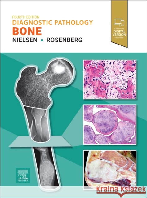 Diagnostic Pathology: Bone G. Petur Nielsen Andrew E. Rosenberg 9780443433573 Elsevier - książka