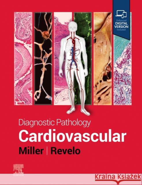 Diagnostic Pathology: Cardiovascular Monica P., MD, PhD (Professor of Pathology, University of Utah School of Medicine, Medical Director of Renal and Cardiov 9780323936200 Elsevier - Health Sciences Division - książka