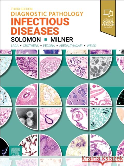 Diagnostic Pathology: Infectious Diseases Dan, MD, MSc(Epi), MBA (Consultant Pathologist, Executive Director, & Medical Director, Libragem Consulting, LLC, Palm S 9780443124778 Elsevier Health Sciences - książka