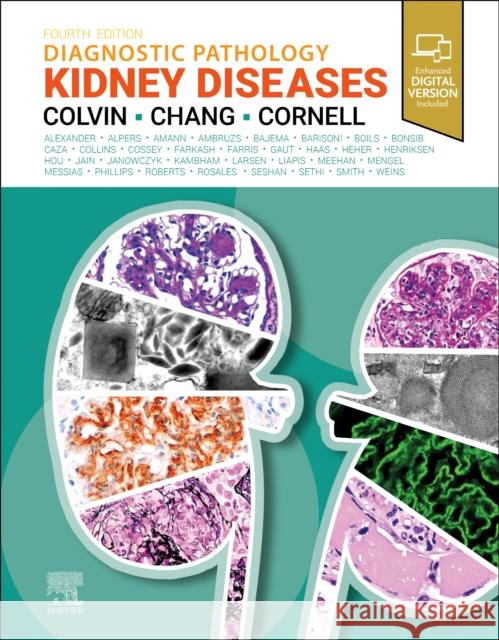 Diagnostic Pathology: Kidney Diseases Robert B. Colvin Anthony Chang Lynn D. Cornell 9780443107177 Elsevier Health Sciences - książka