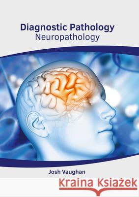 Diagnostic Pathology: Neuropathology Josh Vaughan 9781639272914 American Medical Publishers - książka