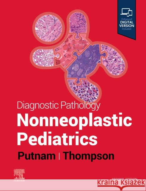 Diagnostic Pathology: Nonneoplastic Pediatrics Angelica R. Putnam Karen S. Thompson 9780323796668 Elsevier - Health Sciences Division - książka