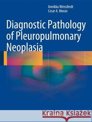 Diagnostic Pathology of Pleuropulmonary Neoplasia Cesar A. Moran Annikka Weissferdt 9781441907868 Springer - książka
