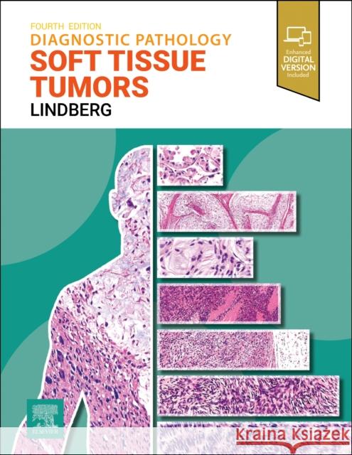 Diagnostic Pathology: Soft Tissue Tumors Matthew R. Lindberg 9780443109362 Elsevier Health Sciences - książka