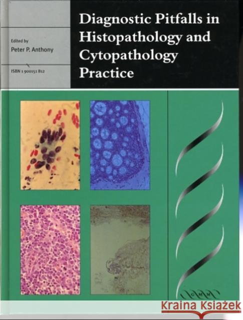 Diagnostic Pitfalls in Histopathology and Cytopathology Practice Peter Anthony Peter P. Anthony 9781900151818 Cambridge - książka