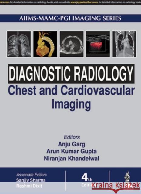 Diagnostic Radiology: Chest and Cardiovascular Imaging Anju Garg 9789352703081 Jp Medical Ltd - książka