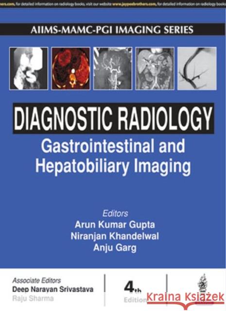 Diagnostic Radiology: Gastrointestinal and Hepatobiliary Imaging Arun Kumar Gupta 9789386261977 Jaypee Brothers, Medical Publishers Pvt. Ltd. - książka
