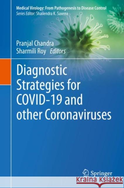 Diagnostic Strategies for Covid-19 and Other Coronaviruses Chandra, Pranjal 9789811560057 Springer - książka