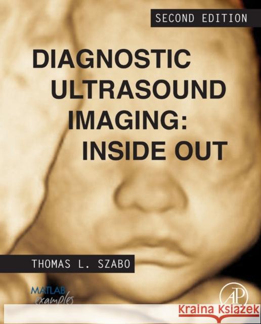 Diagnostic Ultrasound Imaging: Inside Out Thomas Szabo 9780123964878  - książka