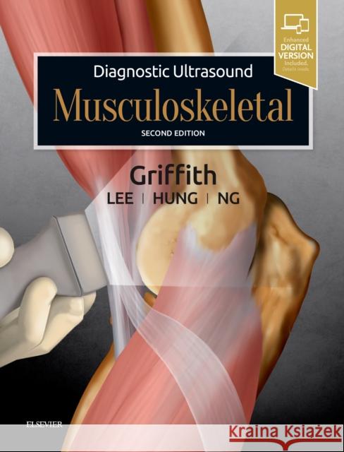 Diagnostic Ultrasound: Musculoskeletal James F. Griffith 9780323570138 Elsevier - książka