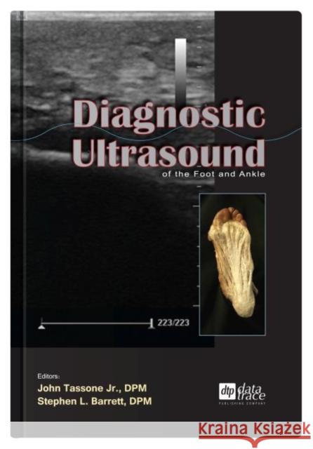 Diagnostic Ultrasound of the Foot and Ankle John Tassone Stephen Barrett  9781574001426 Data Trace Publishing Company - książka