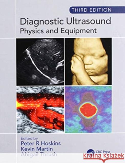 Diagnostic Ultrasound: Physics and Equipment Peter R. Hoskins Kevin Martin Abigail Thrush 9780367190415 CRC Press - książka