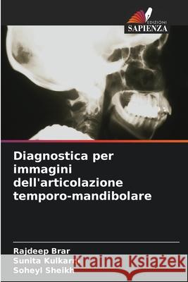 Diagnostica per immagini dell'articolazione temporo-mandibolare Rajdeep Brar Sunita Kulkarni Soheyl Sheikh 9786207674244 Edizioni Sapienza - książka