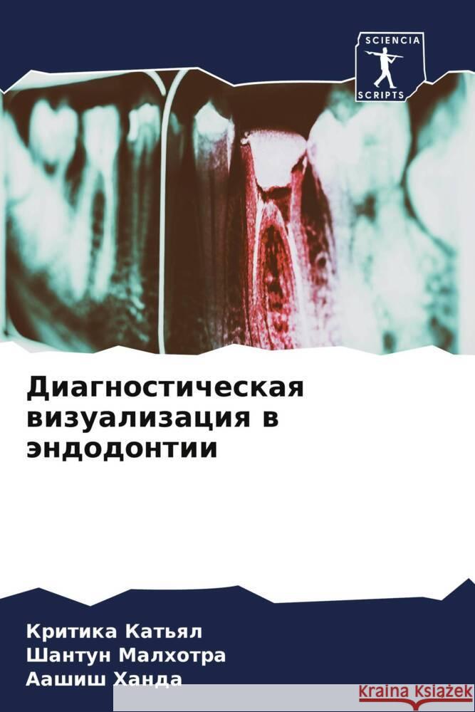 Diagnosticheskaq wizualizaciq w ändodontii Kat'ql, Kritika, Malhotra, Shantun, Handa, Aashish 9786204422039 Sciencia Scripts - książka