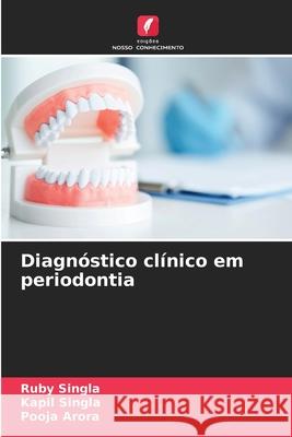 Diagnóstico clínico em periodontia Ruby Singla, Kapil Singla, Pooja Arora 9786204113739 Edicoes Nosso Conhecimento - książka