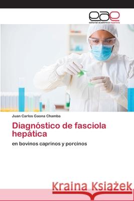 Diagnóstico de fasciola hepática Gaona Chamba, Juan Carlos 9786202156943 Editorial Académica Española - książka