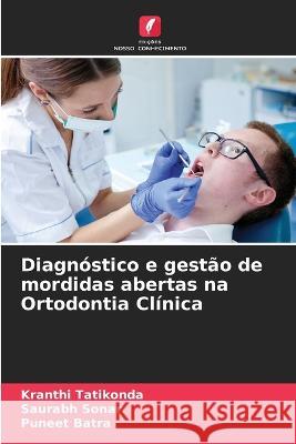 Diagnóstico e gestão de mordidas abertas na Ortodontia Clínica Kranthi Tatikonda, Saurabh Sonar, Puneet Batra 9786205343203 Edicoes Nosso Conhecimento - książka