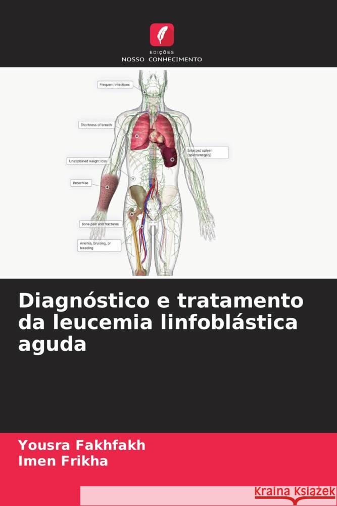 Diagnóstico e tratamento da leucemia linfoblástica aguda Fakhfakh, Yousra, Frikha, Imen 9786208184933 Edições Nosso Conhecimento - książka