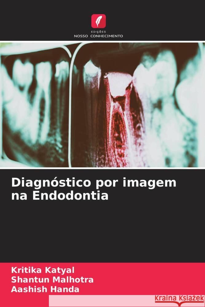 Diagnóstico por imagem na Endodontia Katyal, Kritika, Malhotra, Shantun, Handa, Aashish 9786204422022 Edições Nosso Conhecimento - książka