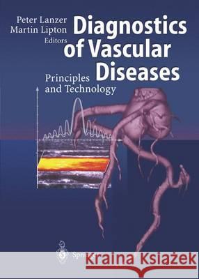 Diagnostics of Vascular Diseases: Principles and Technology Lanzer, Peter 9783642644375 Springer - książka