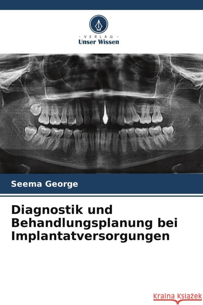 Diagnostik und Behandlungsplanung bei Implantatversorgungen George, Seema 9786208562687 Verlag Unser Wissen - książka
